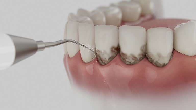 Reliable Emergency Dentist contractor in Apollo Beach, FL by Smile Center Dentistry